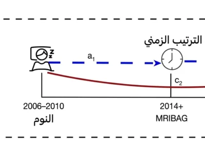 نموذج مبسط للوساطة الزمنية بين مدة النوم وشيخوخة الدماغ والأعراض الاكتئابية.