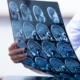 A pessoa segura radiografias e/ou imagens de RM do cérebro, organizadas em linhas para avaliação clínica.