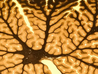 Estrutura transversal com ramificações do tipo rede neural em tons de marrom e dourado, parecida com o tecido cerebral.