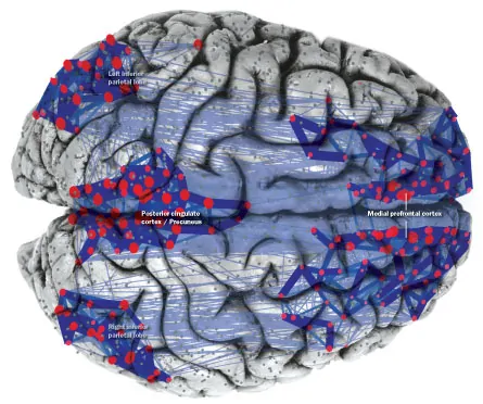 A rede em repouso. Implicações no Alzheimer, esquizofrenia e autismo Representação 3D do cérebro com a Rede em Repouso (DMN) destacada e conexões entre regiões, em tons de vermelho e azul.