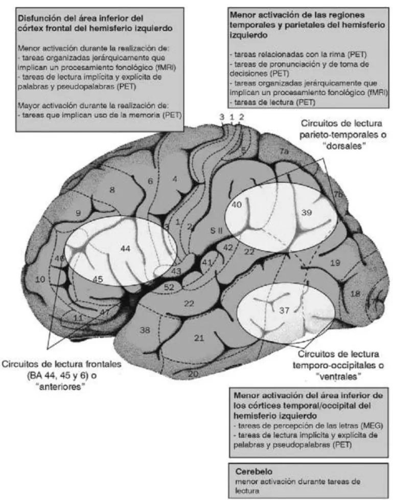 Diagrama cerebral centrado em áreas de leitura e funções executivas, com circuitos frontais e temporo-occipitais.