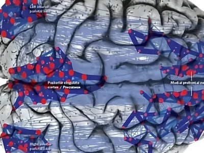 A rede em repouso. Repercussão em Alzheimer, esquizofrenia e autismo