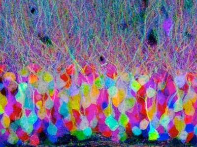 Brainbow: neurônios coloridos em um cérebro, com axônios e dendritos visíveis entre tons de rosa, azul e verde.