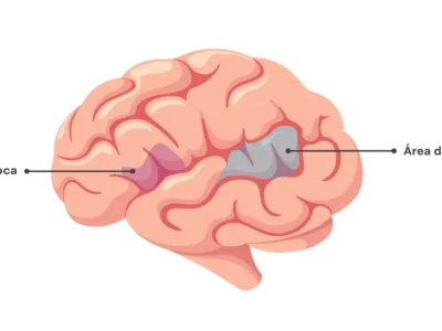 Diagrama do cérebro em perfil esquerdo com as áreas de Broca e Wernicke etiquetadas e coloridas para identificar as funções da linguagem.