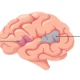 Diagrama do cérebro em perfil esquerdo com as áreas de Broca e Wernicke etiquetadas e coloridas para identificar as funções da linguagem.
