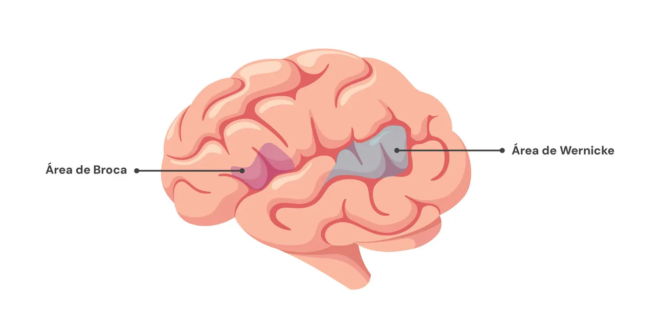 Diagrama do cérebro em perfil esquerdo com áreas de Broca e Wernicke rotuladas e coloridas para identificar as funções da linguagem.