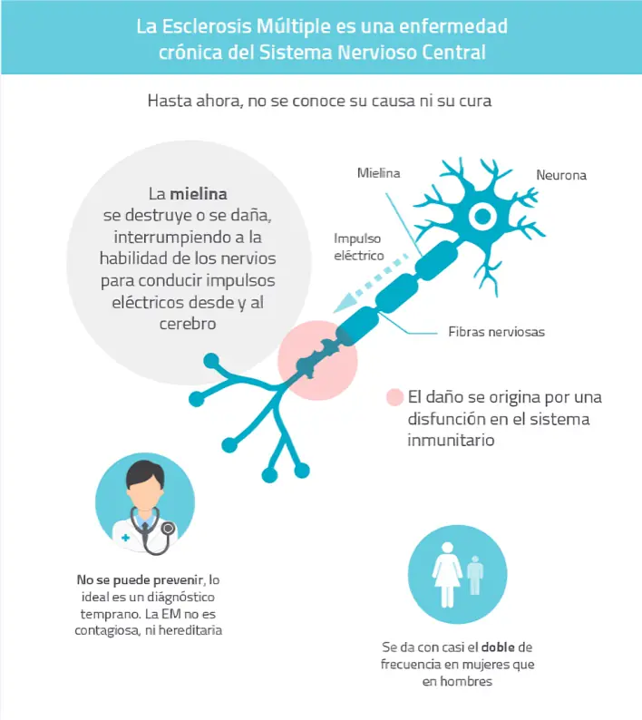 Ilustração do cérebro com áreas destacadas que mostram lesões da Esclerose Múltipla e ênfase na mielina.