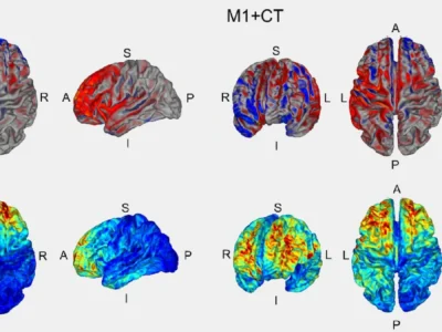 Dois conjuntos de imagens cerebrais em cortes transversais: DLPFC+CT e M1+CT, com barras de cores e etiquetas de orientação.