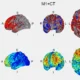 Dois conjuntos de imagens cerebrais em cortes transversais: DLPFC+CT e M1+CT, com barras de cores e etiquetas de orientação.