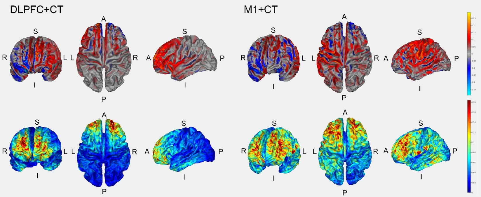 Dois conjuntos de imagens cerebrais em cortes transversais: DLPFC+CT e M1+CT, com barras de cor e rótulos de orientação.