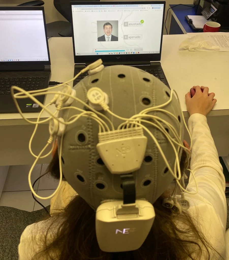 Montagem HD-tDCS com capacete e eletrodos adesivos, cabos visíveis, em frente a dois laptops em reabilitação neuropsicológica.