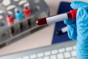 Prevalência da patologia de Alzheimer na população geral