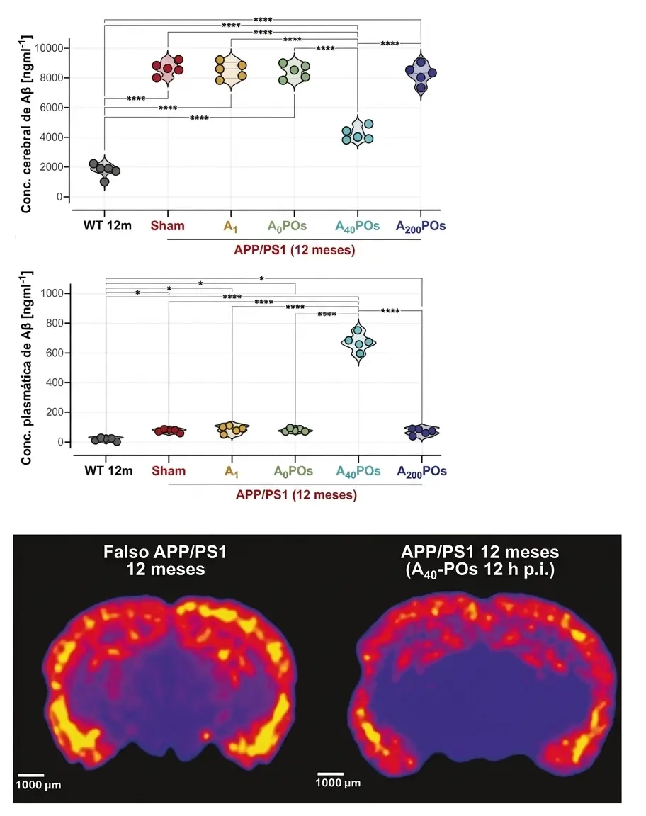 Redução da carga cerebral de beta-amiloide após o tratamento com A40-POs em camundongos APPPS1.