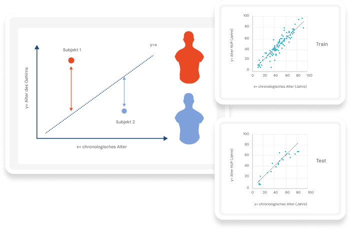 NeuronUP Alter des Gehirns