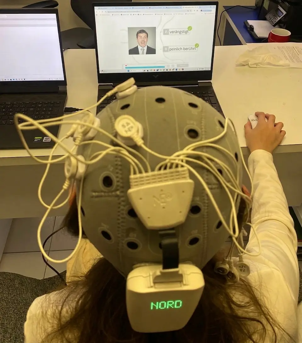HD-tDCS-Aufbau mit Helm und Klebeelektroden, sichtbaren Kabeln und zwei Laptops in der neuropsychologischen Rehabilitation.