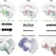 An der Regulation des Schlaf-Wach-Zyklus beteiligte neuronale Netzwerke und Verteilung der Pathologie bei verschiedenen neurodegenerativen Erkrankungen.