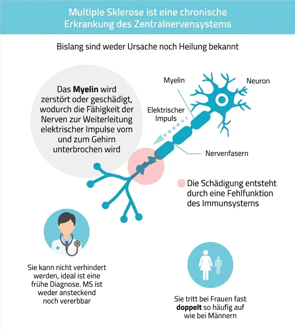 Darstellung eines Gehirns mit hervorgehobenen Bereichen, die Läsionen der Multiplen Sklerose zeigen, mit Schwerpunkt auf dem Myelin.