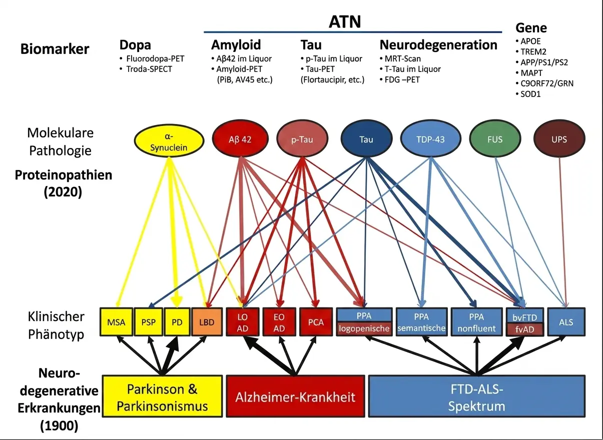 Konzeptdiagramm zu den Beziehungen zwischen Biomarkern, Proteinen und klinischen Phänotypen bei neurodegenerativen Demenzen mit Pfeilen.