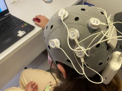 HD-tDCS-Aufbau für Schmerzprotokoll III: Helm mit Elektroden und Kabeln neben einem Computer.