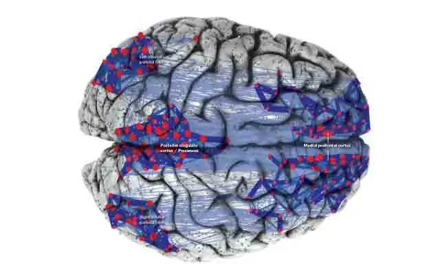 Illustration en 3D du cerveau avec des zones éclairées mettant en évidence le réseau par défaut (DMN) pour une visualisation anatomique.