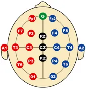 Diagramme EEG avec distribution des électrodes en F, C, P, T et O ; CZ sur la ligne médiane, et marques rouges et bleues.