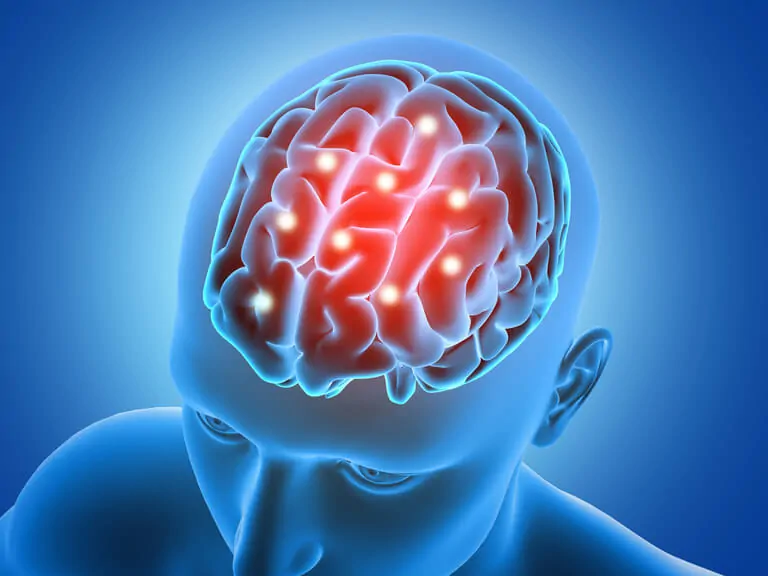 Représentation graphique d'un cerveau humain en bleu clair avec des zones rouges mises en évidence, vue supérieure, pour les fonctions exécutives.