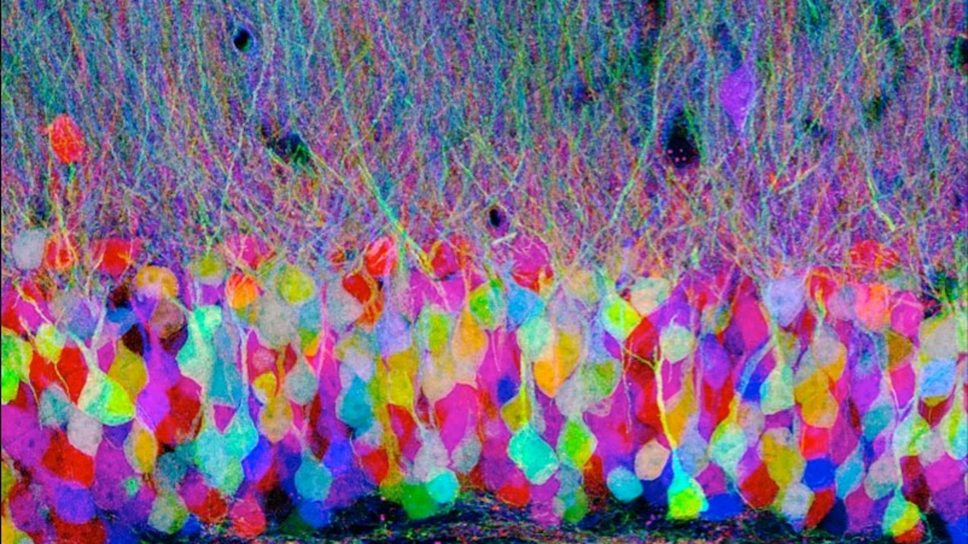 Brainbow : neurones colorés dans un cerveau, avec des axones et des dendrites visibles dans les tons rose, bleu et vert.