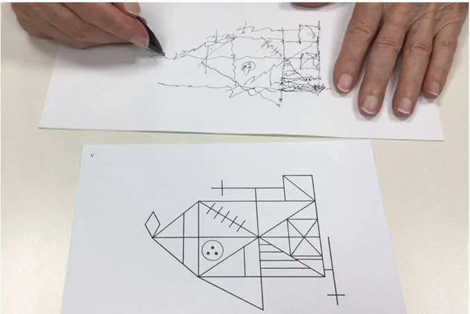 Rééducation neuropsychologique dans la maladie de Parkinson