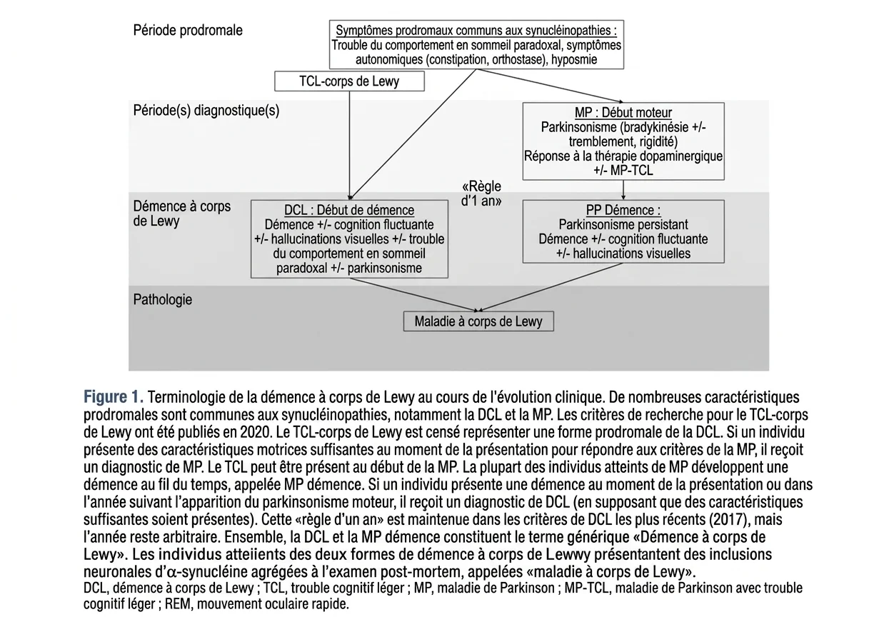 Schéma éducatif comparant la maladie à corps de Lewy et la maladie de Parkinson, avec un focus sur la période prodromique et la pathologie.