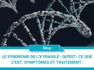 Le syndrome de l'X fragile : qu'est- ce que c'est, symptômes et traitement