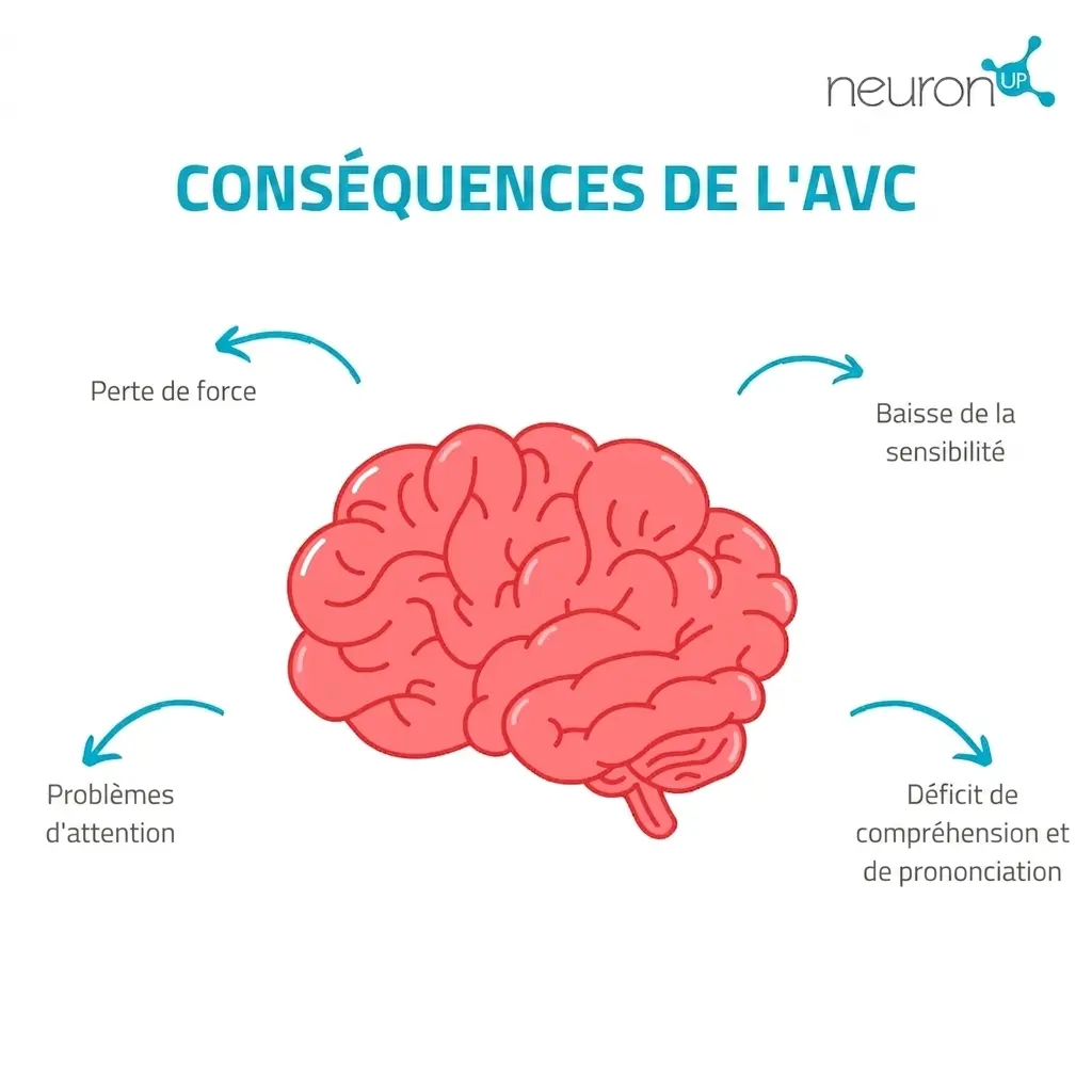 Infographie éducative : cerveau rose avec quatre flèches indiquant les conséquences de l'AVC et les recommandations de rééducation.