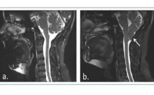 Una breve neuropsicologia dell'autoritarismo