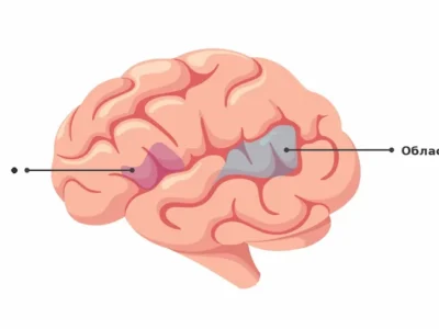 Broca's and Wernicke's areas