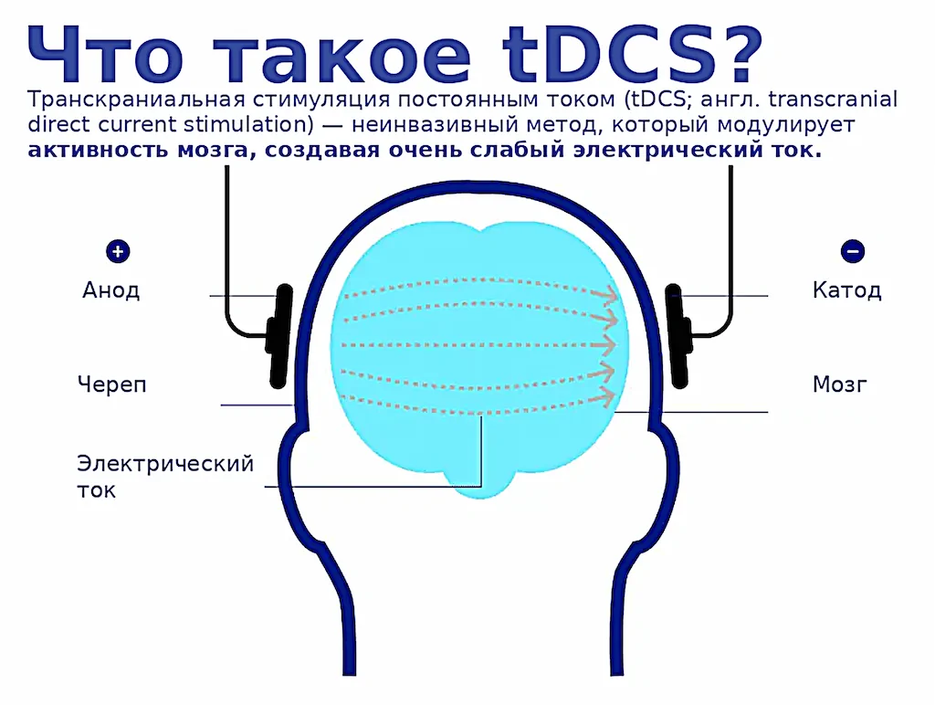 tDCS