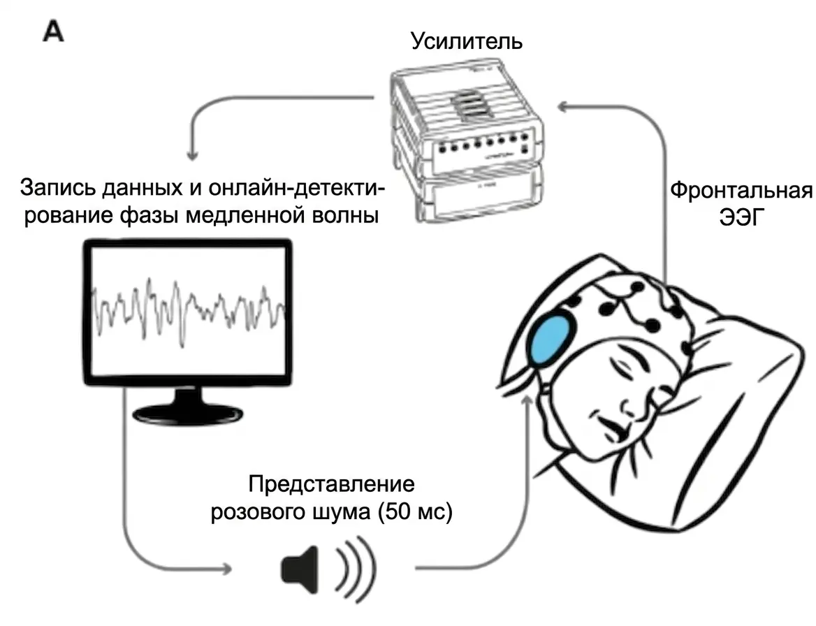 Схема слуховой стимуляции, синхронизированной с медленными волнами сна.