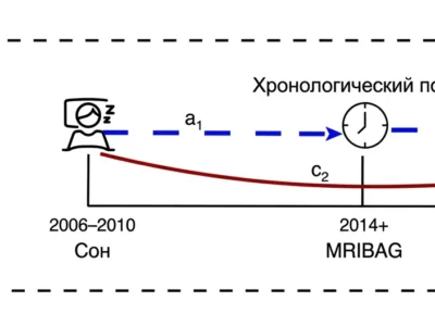 Упрощенная модель временного посредничества между продолжительностью сна, старением мозга и депрессивными симптомами.