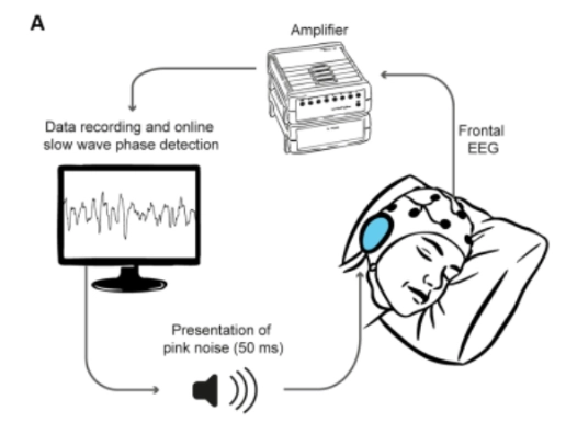 Esquema de la estimulación auditiva sincronizada con las ondas lentas del sueño.