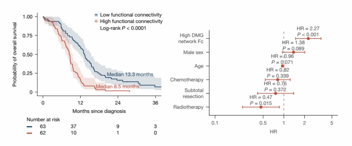 El resultado más relevante del estudio es que la conectividad funcional del tumor con la red DMG se asoció con la supervivencia de los pacientes. En concreto, los niños cuyos tumores estaban más conectados con esta red cerebral presentaron una supervivencia global más corta.
Este hallazgo es importante porque cambia la forma de interpretar estos tumores. No basta con saber en qué zona del cerebro aparece el glioma; también parece fundamental conocer con qué circuitos cerebrales se relaciona. En otras palabras, el pronóstico no depende únicamente de la localización anatómica del tumor, sino también de su integración en una red cerebral concreta.
Para comprobar la solidez de este resultado, los autores lo validaron en dos cohortes independientes. En una cohorte multicéntrica externa de 125 niños, los pacientes con alta conectividad entre el tumor y la red DMG tuvieron una mediana de supervivencia de 8,5 meses, frente a 13,3 meses en aquellos con baja conectividad. En una segunda cohorte de 38 niños con DMG pontino confirmado por biopsia, se observó el mismo patrón: una mayor conectividad con la red DMG se asociaba a un peor pronóstico.